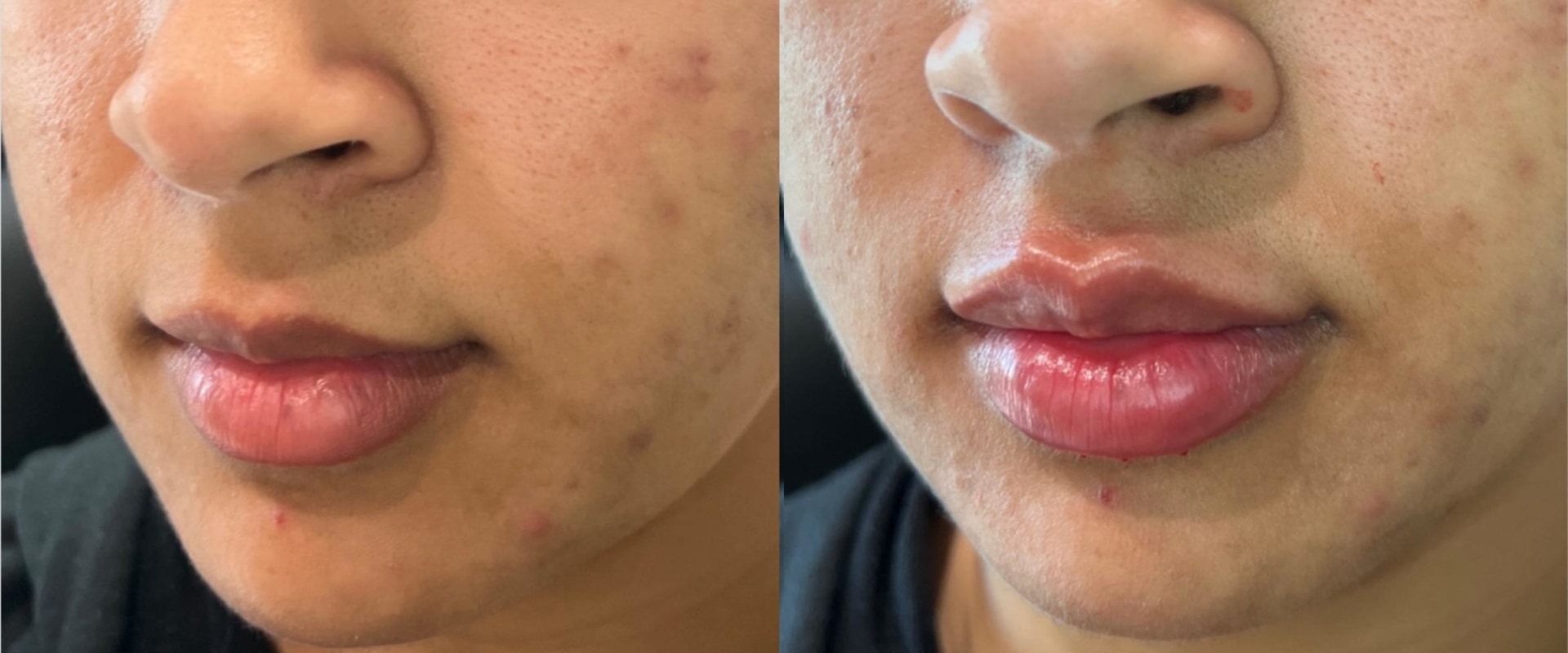 Curated Medical: The Home Of High-Quality Facial Fillers