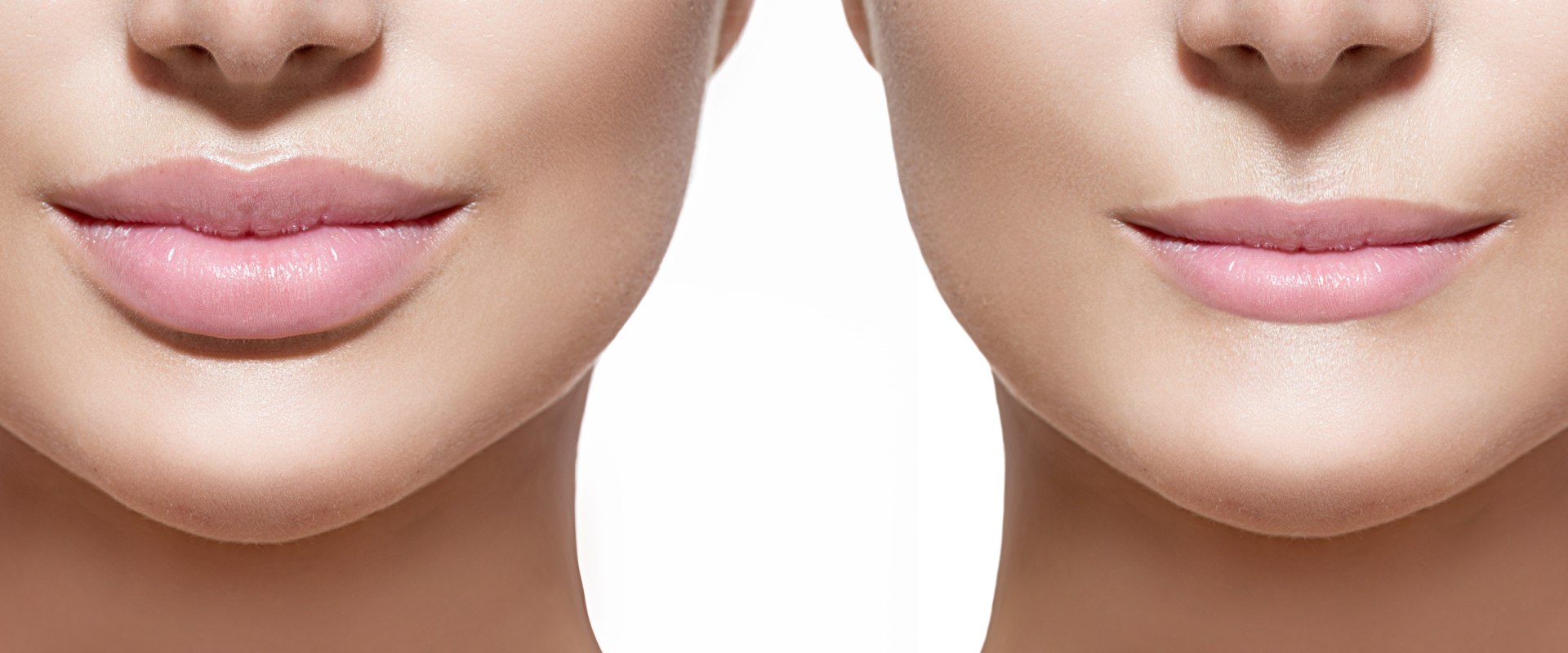 Does Filler Become Permanent? A Comprehensive Guide