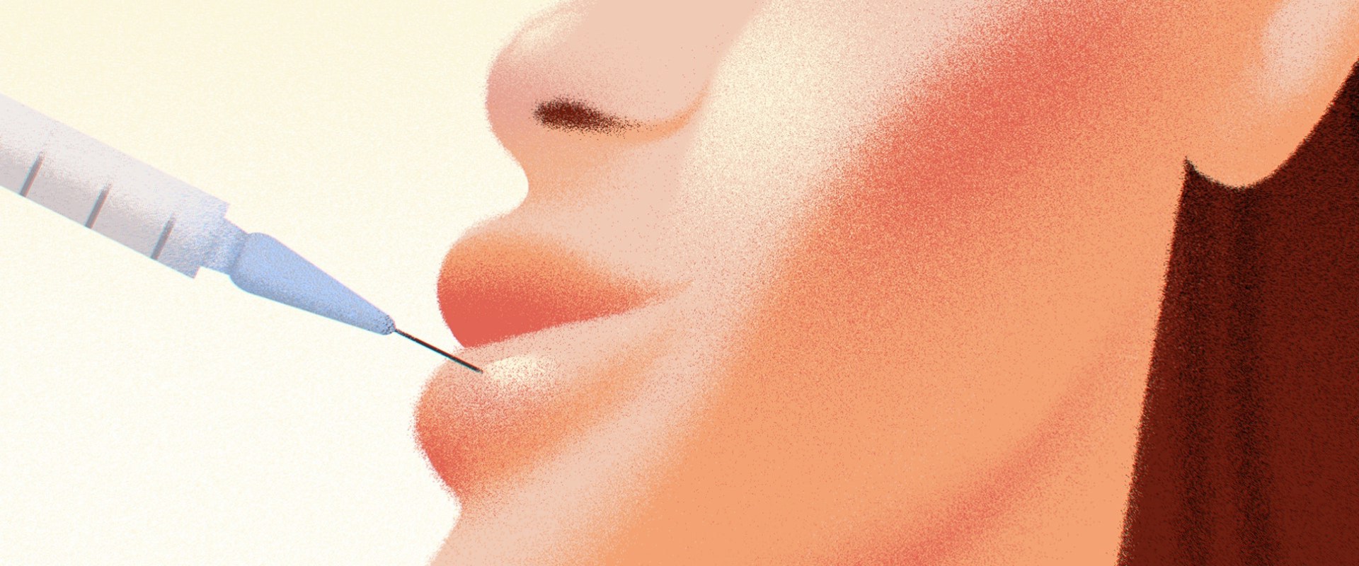 Are Dermal Fillers Safe? An Expert's Perspective