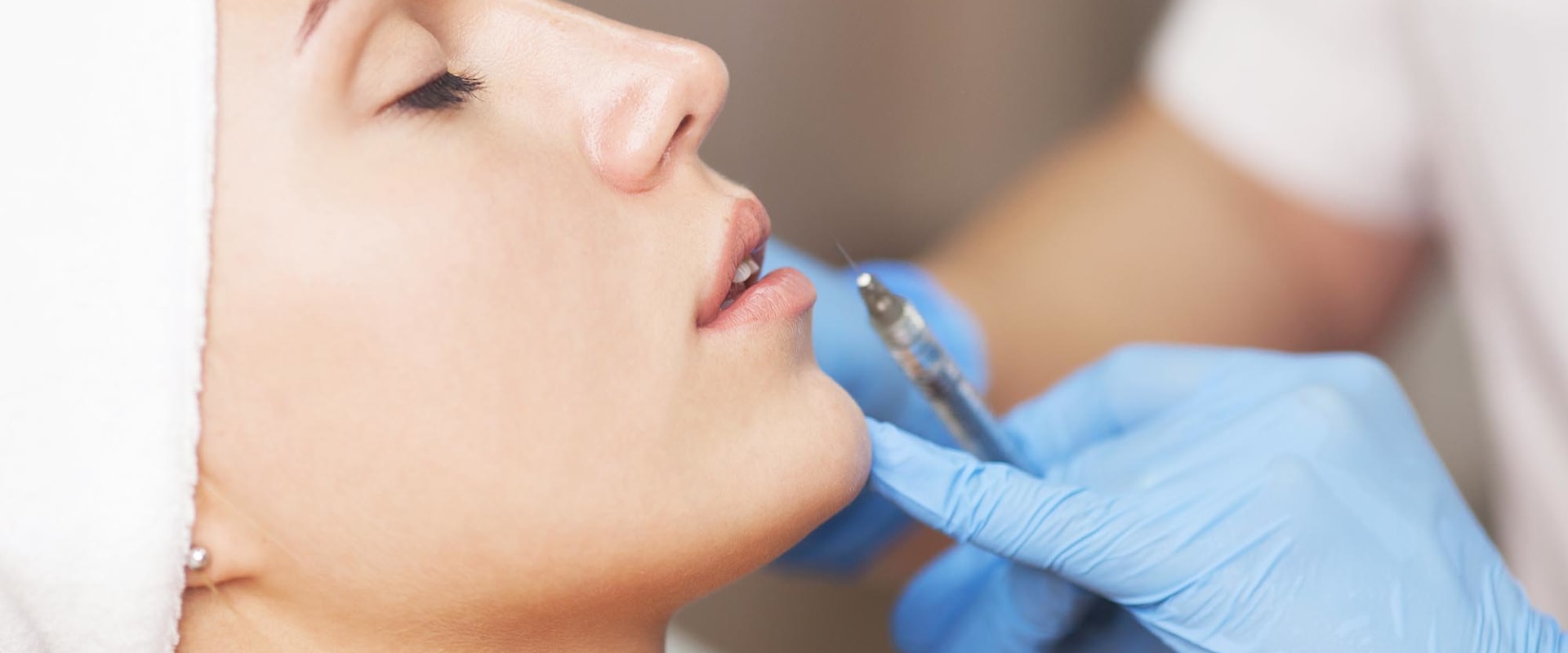 How Long Does It Take for Filler to Migrate?