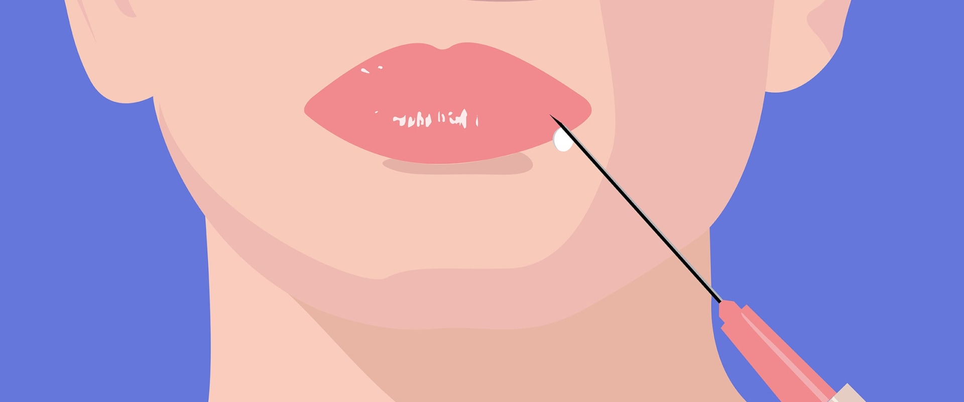 What is the Best Filler to Use for Facial Rejuvenation?