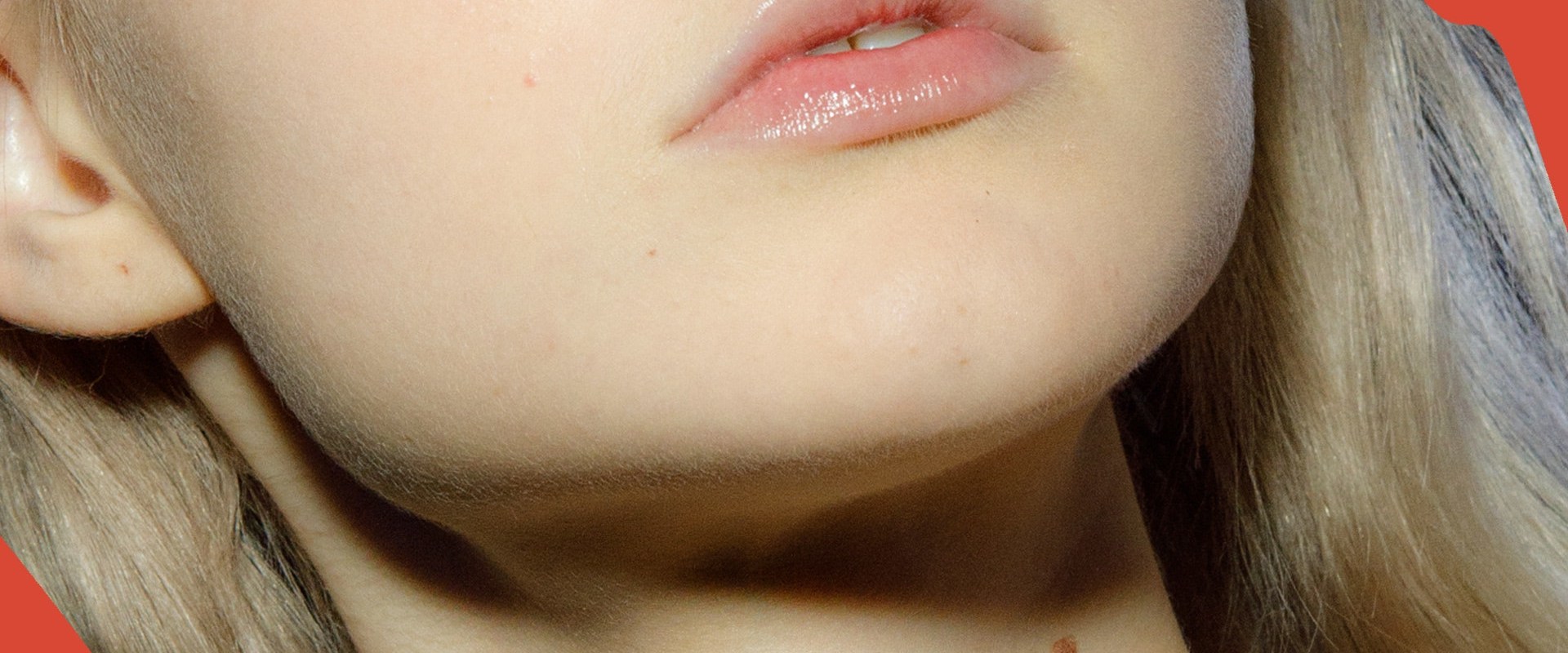 Can Permanent Fillers Become a Reality?