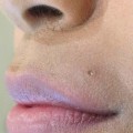 How Much Does a Syringe of Lip Filler Cost?