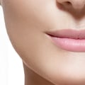 How Long After Filler Can It Move?