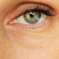Can Under Eye Fillers Reverse the Signs of Aging?