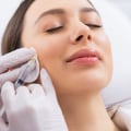 Skin Verse Medical Spa Beverly Hills - Laser Hair Removal Medspa and Injectables: Maintain Your Youth with Facial Fillers