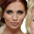 Do Fillers Make You Look Older When They Wear Off?