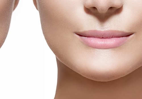 How Long Do Dermal Fillers Last? An Expert's Guide