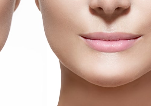 Does Filler Become Permanent? A Comprehensive Guide