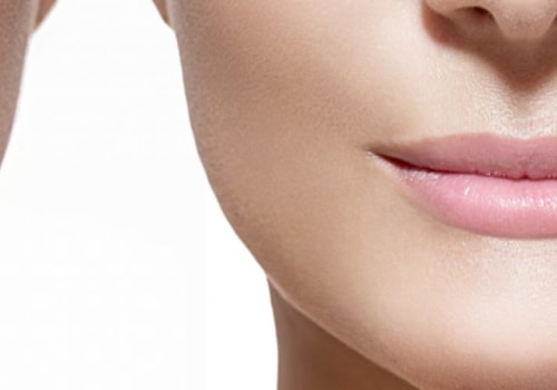 How Long After Filler Can It Move?