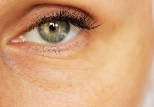 Can Under Eye Fillers Reverse the Signs of Aging?