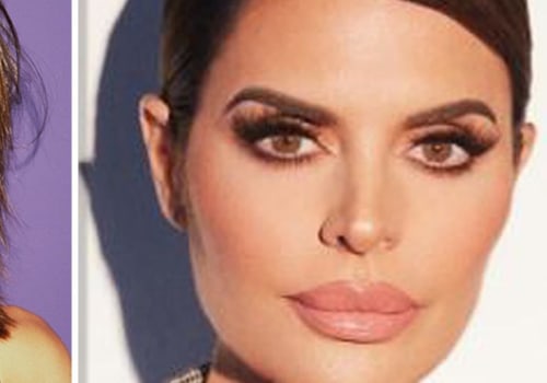 Lip Fillers: A History from the 80s to Now