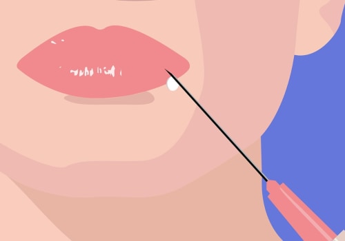 The 5 Most Dangerous Injection Zones for Dermal Fillers