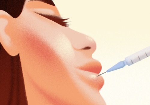 Are Dermal Fillers Safe? An Expert's Perspective