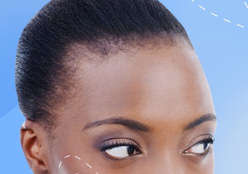 Are Fillers Supposed to Feel Hard? A Comprehensive Guide