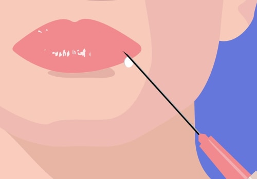 What is the Best Filler to Use for Facial Rejuvenation?