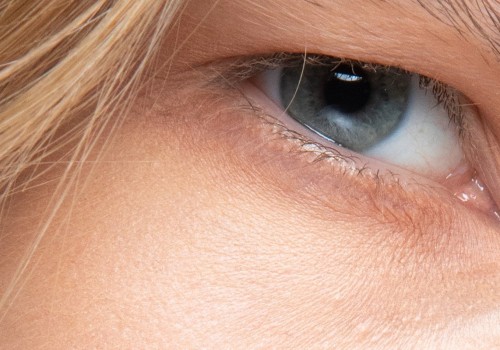 Do Fillers Make Wrinkles Worse?